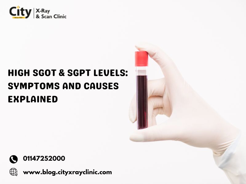 High SGOT & SGPT Levels: Symptoms and Causes Explained